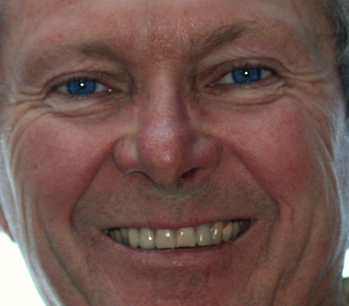 Douglas Gillies, American